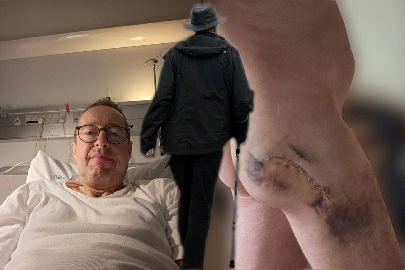 Sygeleje og operationssår efter hofteoperation.
