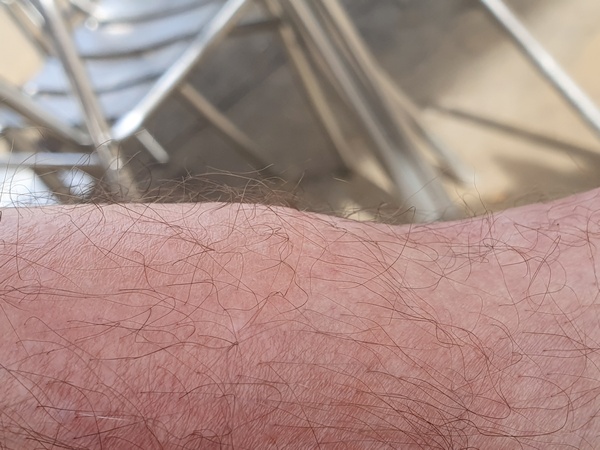 Now it is my turn to have swollen ancles. Three days in a row with +35 km took their toll.