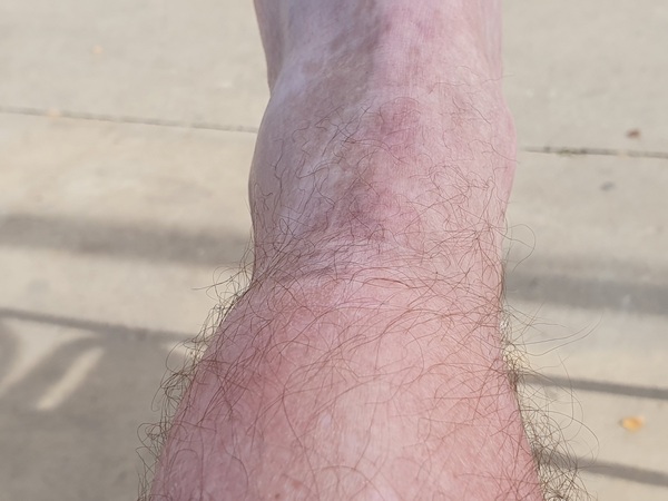 Now it is my turn to have swollen ancles. Three days in a row with +35 km took their toll. I had to walk really slowly.